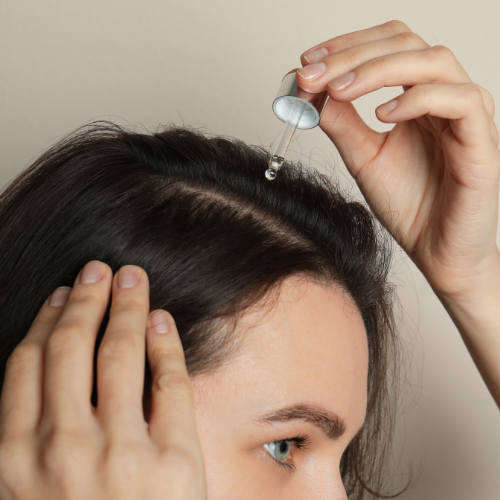 Receding Hairlines in Women: Causes & How Chebe + Amla Can Help
